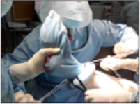 【安全性】使用无菌弹性驱血止血带后的肺栓塞