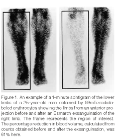 【生理机能】在健康男性下肢进行的驱血方法