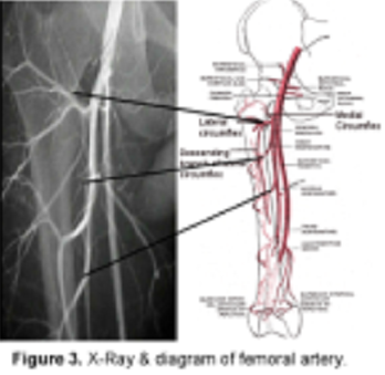 【生理和技术说明】病理生理学和HemaClear止血失败的预防