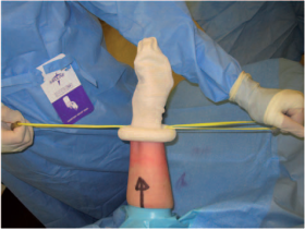 【生理学和生物学】硅胶环止血带和气囊止血带造成的疼痛感和不适感