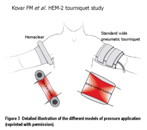 【生理学和生物学】Never compression and pain in human volunteers with narrow vs wide tourniquets