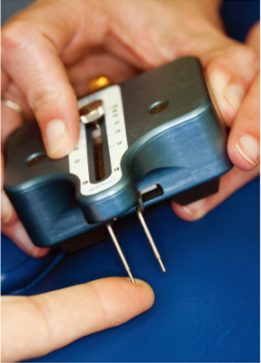 【生理学和生物学】Upper Extremity Never Function and Pain in Human Volunteers with Narrow versus Wide Tourniquets